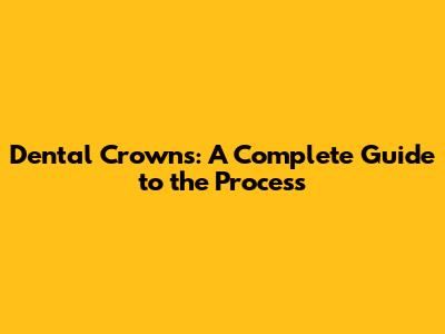 Dental Crowns: A Complete Guide to the Process