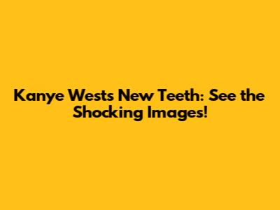 Kanye West's New Teeth: See the Shocking Images!
